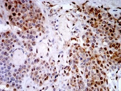 PSMC3 Antibody