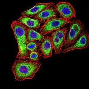 PSMC3 Antibody