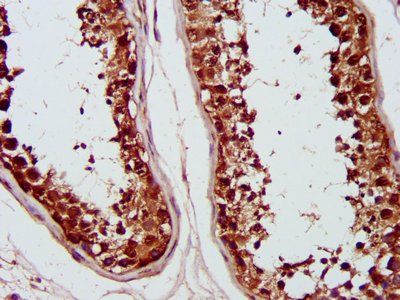 PSMC6 Antibody