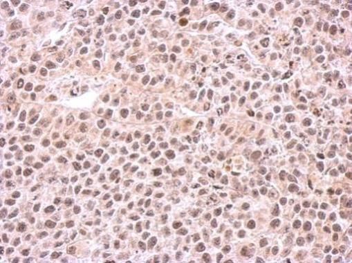 PSMC6 antibody