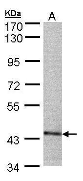 proteasome 26S subunit, ATPase 6 Antibody
