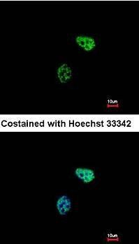 PSMC6 antibody