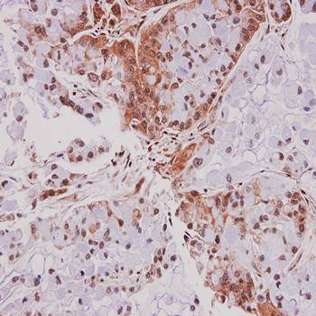 PSMC6 antibody