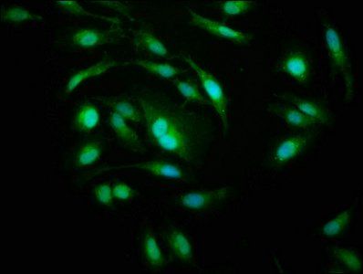 PSMD10 Antibody