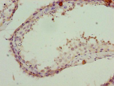 PSMD10 Antibody
