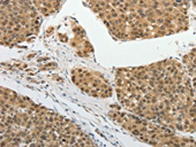PSMD14 Antibody