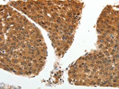 PSMD14 Antibody
