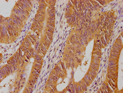 PSMD14 antibody