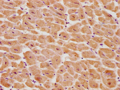 PSMD14 antibody