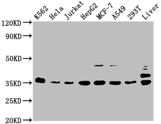 PSMD14 antibody