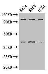 PSMD2 antibody