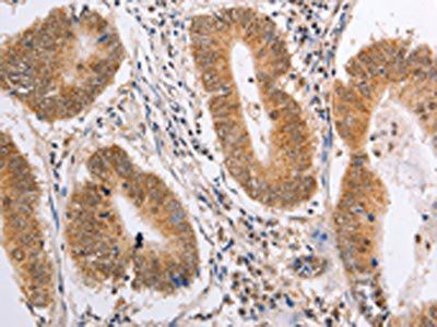 PSMD3 Antibody