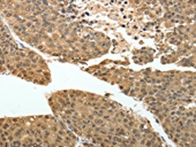 PSMD3 Antibody