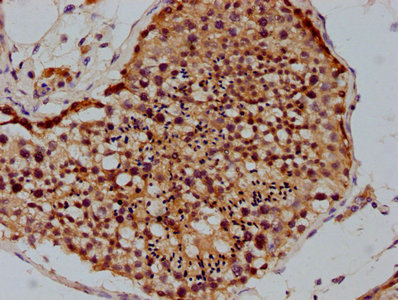 PSMD4 Antibody