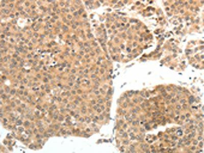 PSMD7 Antibody