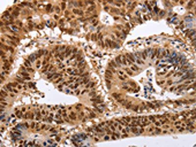 PSMD8 Antibody