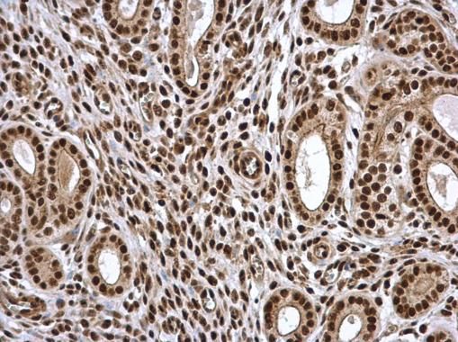 PSME3 antibody