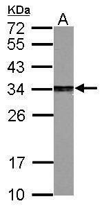 proteasome activator subunit 3 Antibody