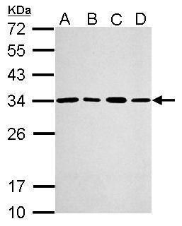 proteasome activator subunit 3 Antibody