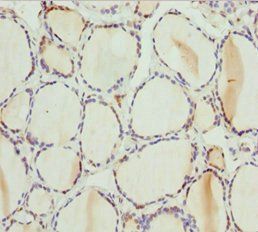 PSPH Antibody