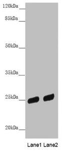 PSPH antibody