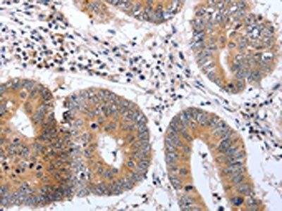 PSPN Antibody
