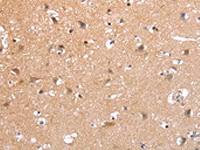 PSPN Antibody