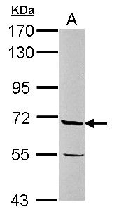 PSR antibody