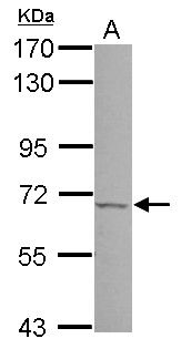 PSR antibody