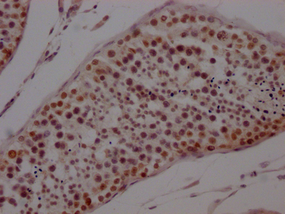 PTBP1 Recombinant Monoclonal Antibody