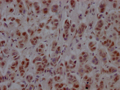 PTBP1 Recombinant Monoclonal Antibody