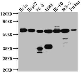 PTBP1 Recombinant Monoclonal Antibody