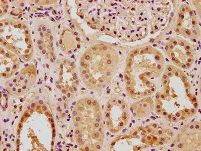 PTBP3 Antibody