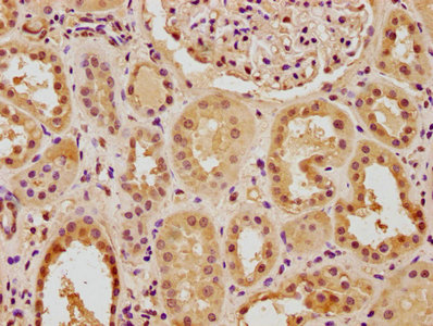 PTBP3 antibody