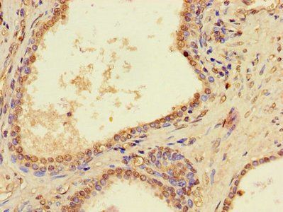 PTCD2 Antibody