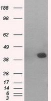PTCH1 Antibody