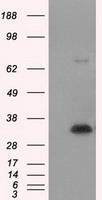 PTCH1 Antibody