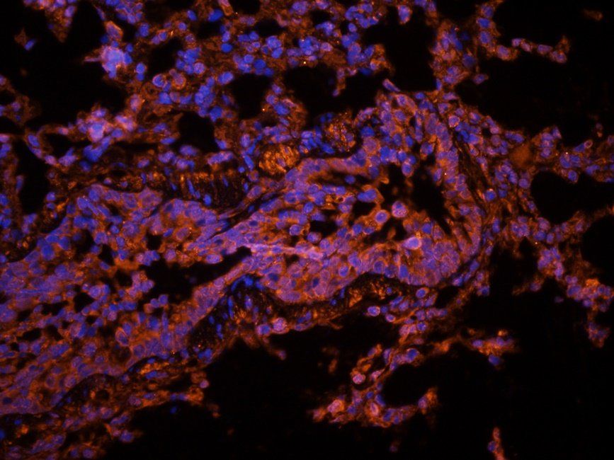 PTCH1 antibody