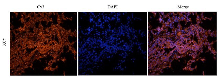 PTCH1 antibody