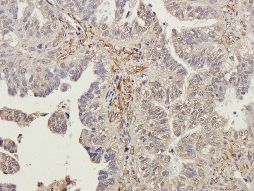 PTCH1 antibody