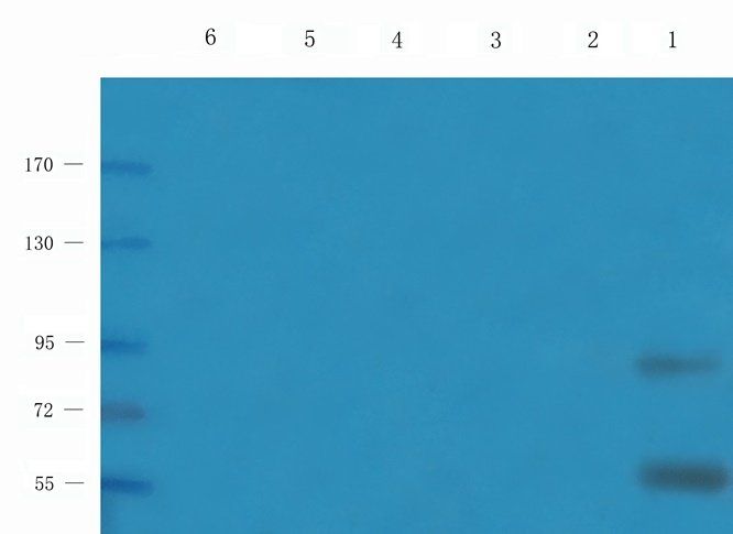 PTCH1 antibody