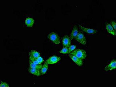 PTCH1 Antibody