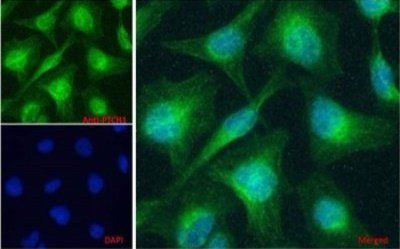 Goat anti-PTCH1 (aa266-280) Antibody