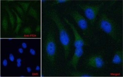Goat anti-PTCH (C Terminus) Antibody