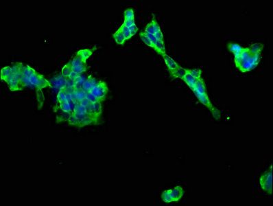 PTCH2 Antibody