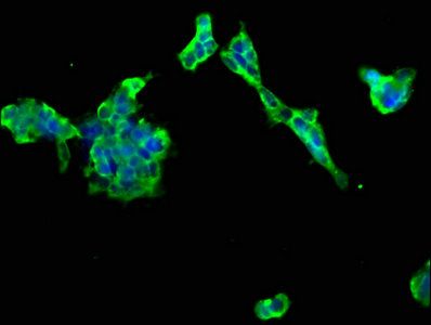 PTCH2 antibody