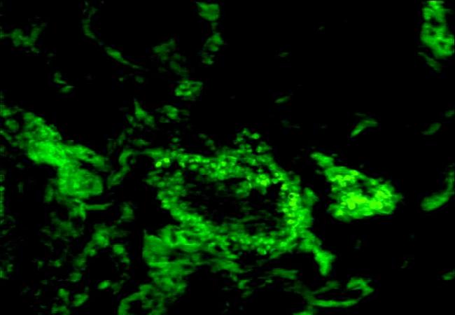 PTCH antibody (FITC)