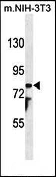 PTCHD1 antibody