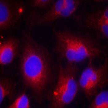 PTEN(Phospho-Ser380) Antibody