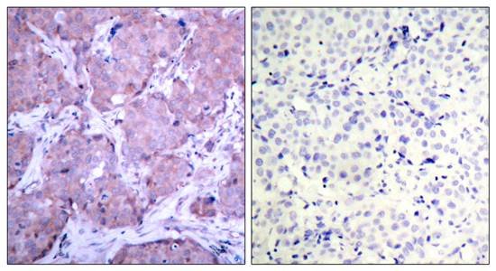 PTEN(Phospho-Ser380) Antibody